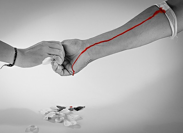 Besplatne biohemijske analize za dobrovoljne davaoce koji sutra daju krv