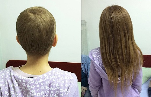 "Kilometrom kose" napravili perike za bolesne devojčice