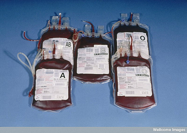 Nedostaje krv A krvne grupe