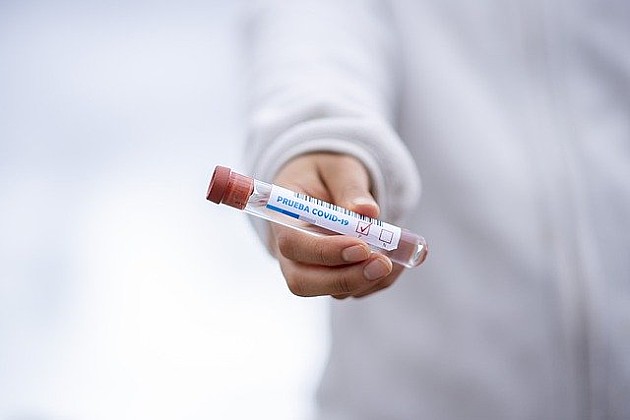 Još dvoje preminulo od koronavirusa u Novom Sadu, od danas testiranje na antitela