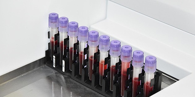 Ponovo radi Služba laboratorijske dijagnostike u Veterniku