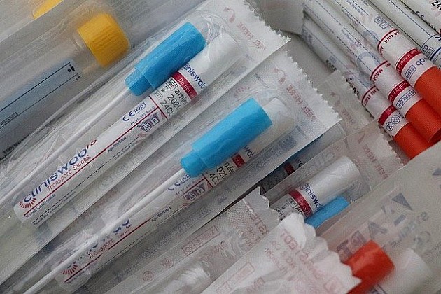 Novi Sad nabavlja brze testove na respiratorne infekcije za decu, deca će biti testirana kod pedijatara
